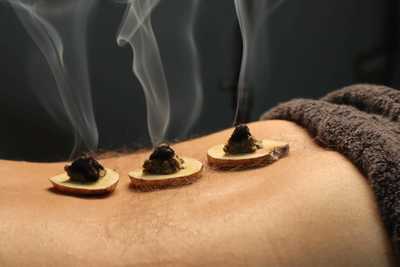 Moxibustion