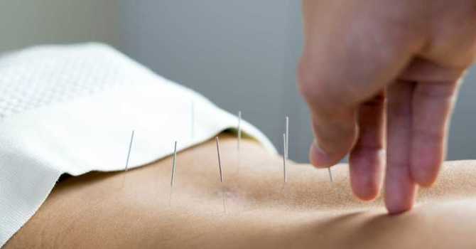 Acupuncture + Traditional Chinese Medicine (TCM)